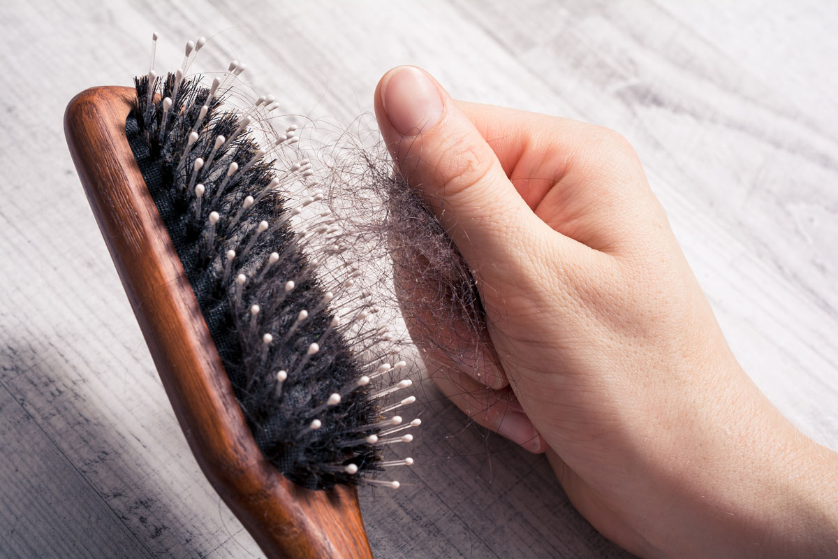 Alopecia da trazione cos'è