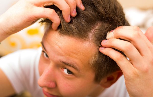 Perdita Capelli Stress