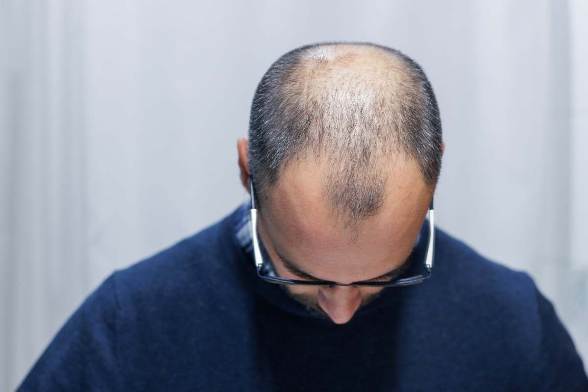 8 consigli per mantenere i propri capelli il più a lungo possibile