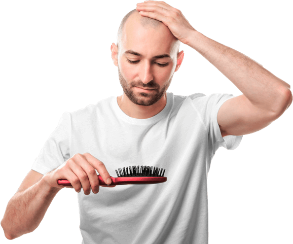 ragazzo con calvizie maschile