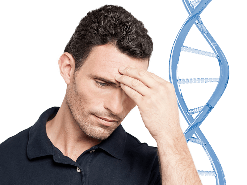 cause-calvizie-uomo-alopecia-androgenetica