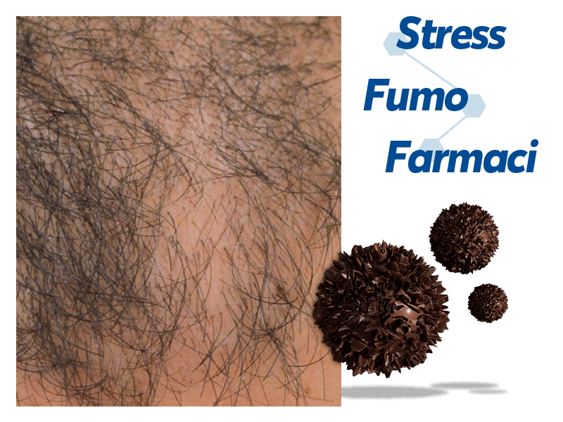 cause della caduta capelli nell'uomo