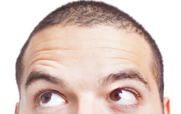 trapianto capelli estero