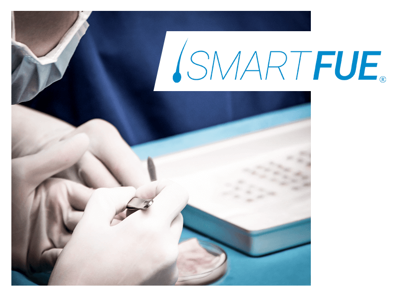 Caduta-capelli-menopausa-soluzioni-smart-fue