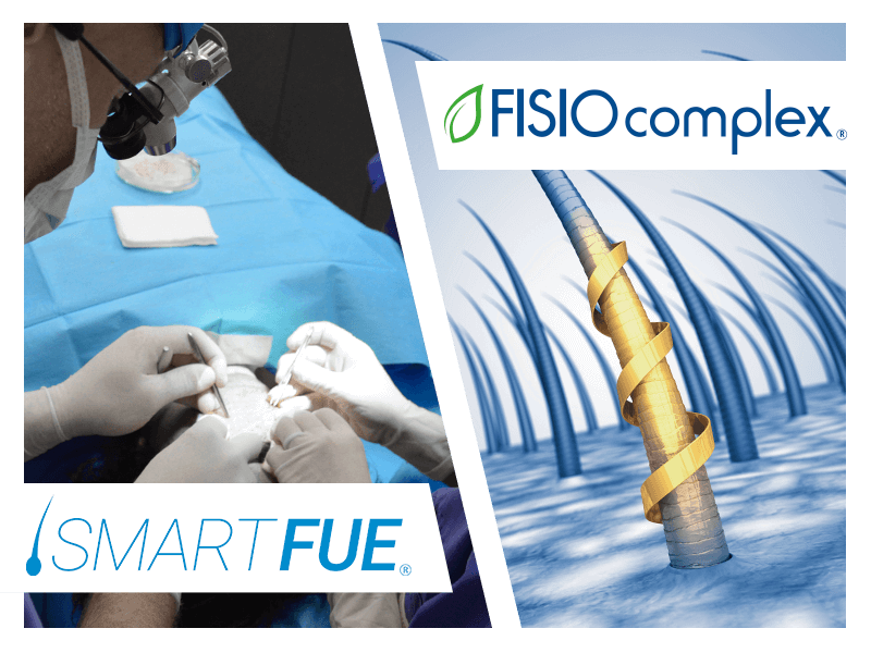 calvizie-trattamenti-fisio-complex-smart-fue