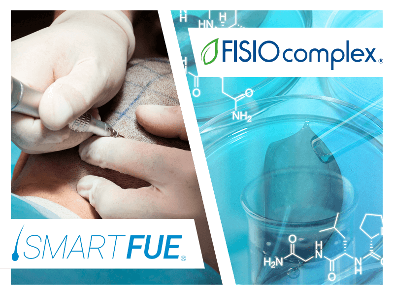 cause-caduta-capelli-alopecia-seborroica-soluzioni-smart-fue-fisio-complex
