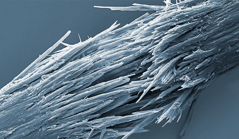 cause-caduta-capelli-alopecia-trazione-capelli-trattati-chimicamente