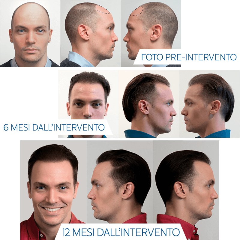 istituto-helvetico-sanders-esperienza-filippo-risultati