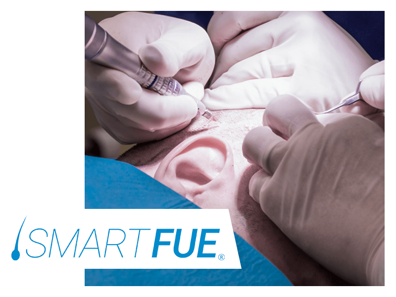 istituto-helvetico-sanders-esperienza-filippo-smart-fue