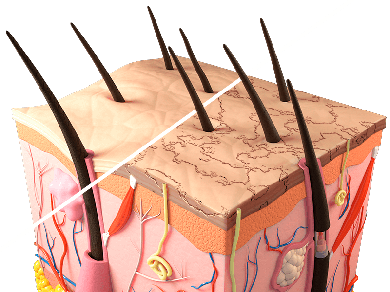 Problemi del cuoio capelluto: la cute secca