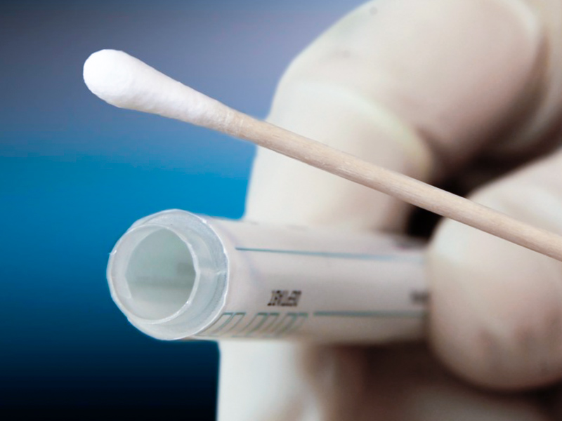 test-dna-hair-genetic-come-funziona