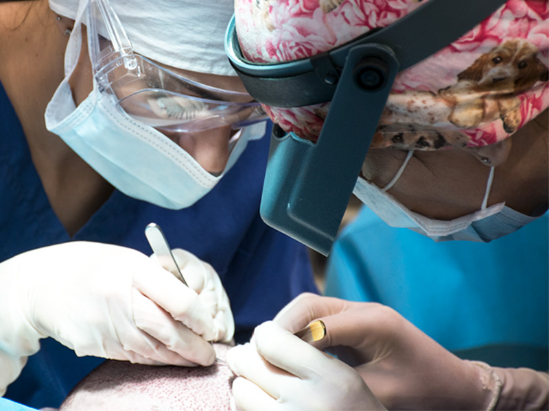 trapianto-smart-fue-come-funziona-esperienza-tecnica