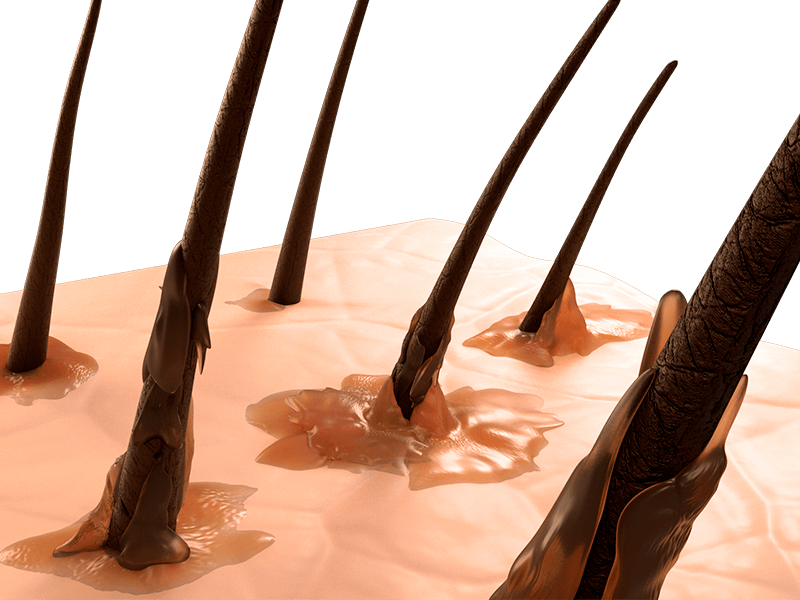 l'eccesso di sebo causa i capelli grassi