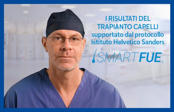 perché non andare all'estero per un trapianto capelli