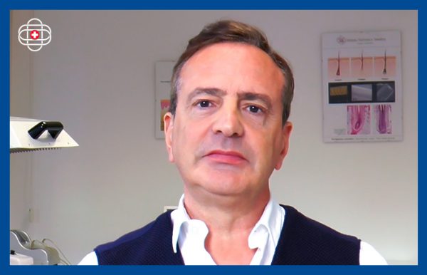 Franco Massimo video testimonianza dopo il trapianto di capelli Smart Fue