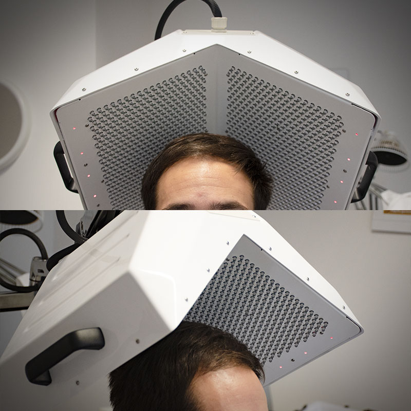 immagine_articolo_micro_photo_stym