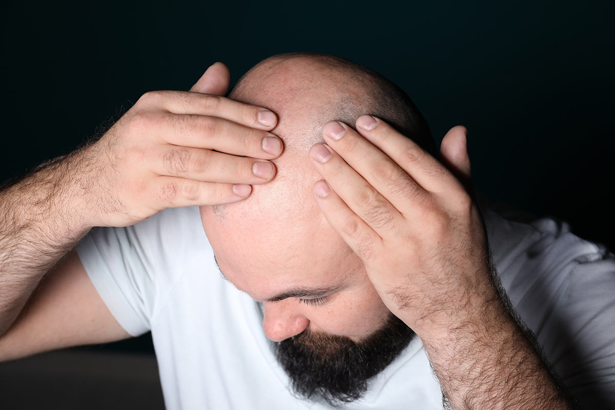 In quanto tempo crescono i capelli