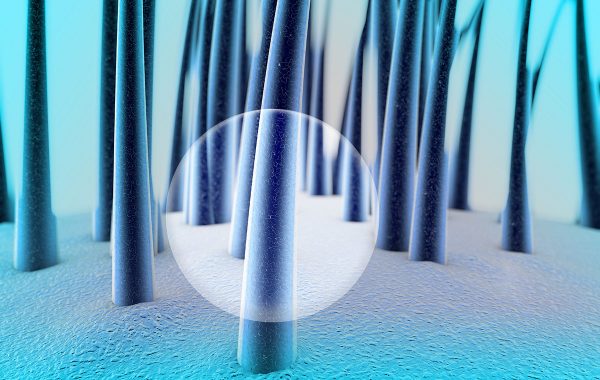 Cos'è la seborrea dei capelli e quali sono i rimedi