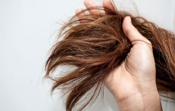 Capelli stopposi, quali sono le cause e come rimediare
