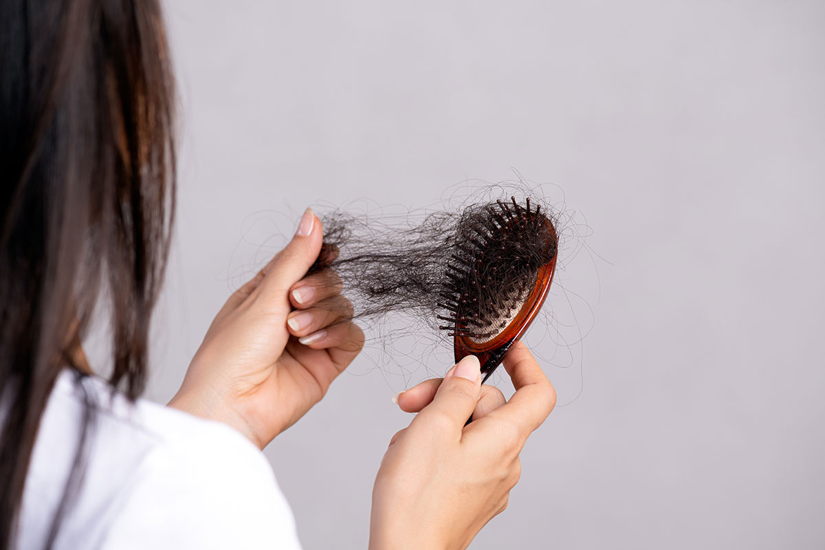 Perdita improvvisa dei capelli