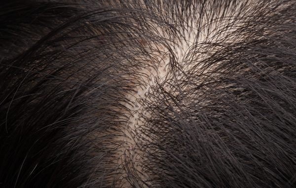 Capelli Ruvidi e Sfibrati cosa fare