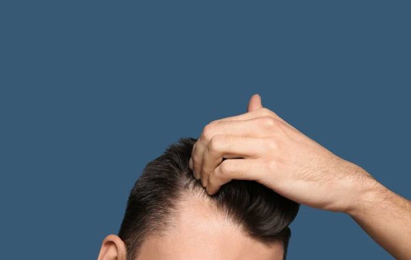 Effetti dell'Alcol sui Capelli