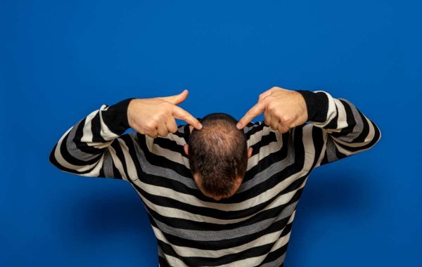 Calvizie e Rasatura Capelli, Consigli e Rimedi