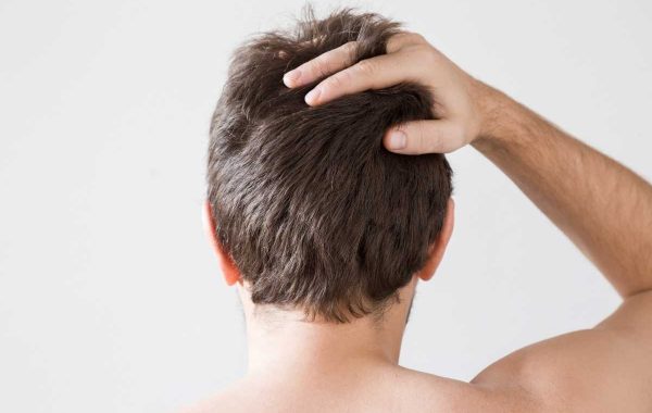 Capelli disidratati, quali sono le cause e perché non bisogna trascurarli