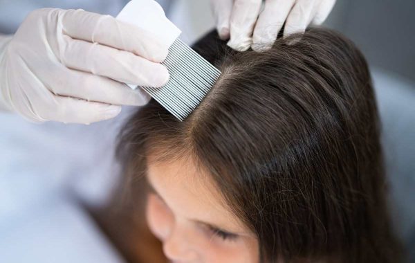 Alopecia infantile, quali sono le cause e come intervenire